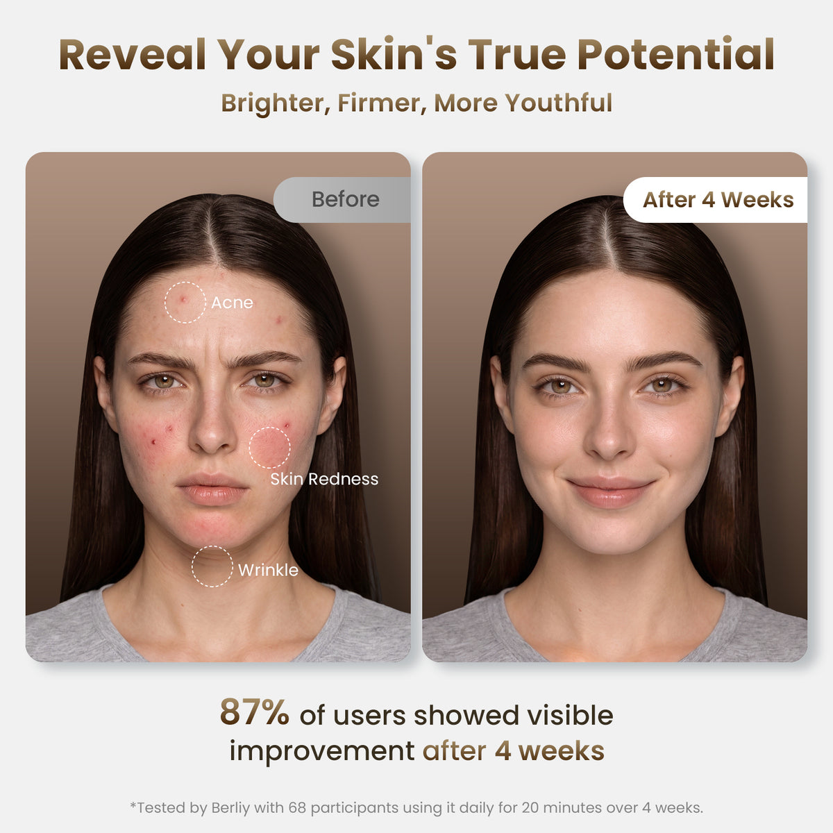 BERLIY four-week before-and-after comparison highlighting the appearance of blemishes, redness and fine lines.